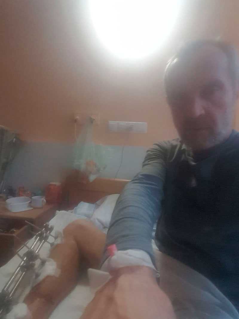 В Киеве водитель такси после нападения может остаться без ноги, нужна помощь